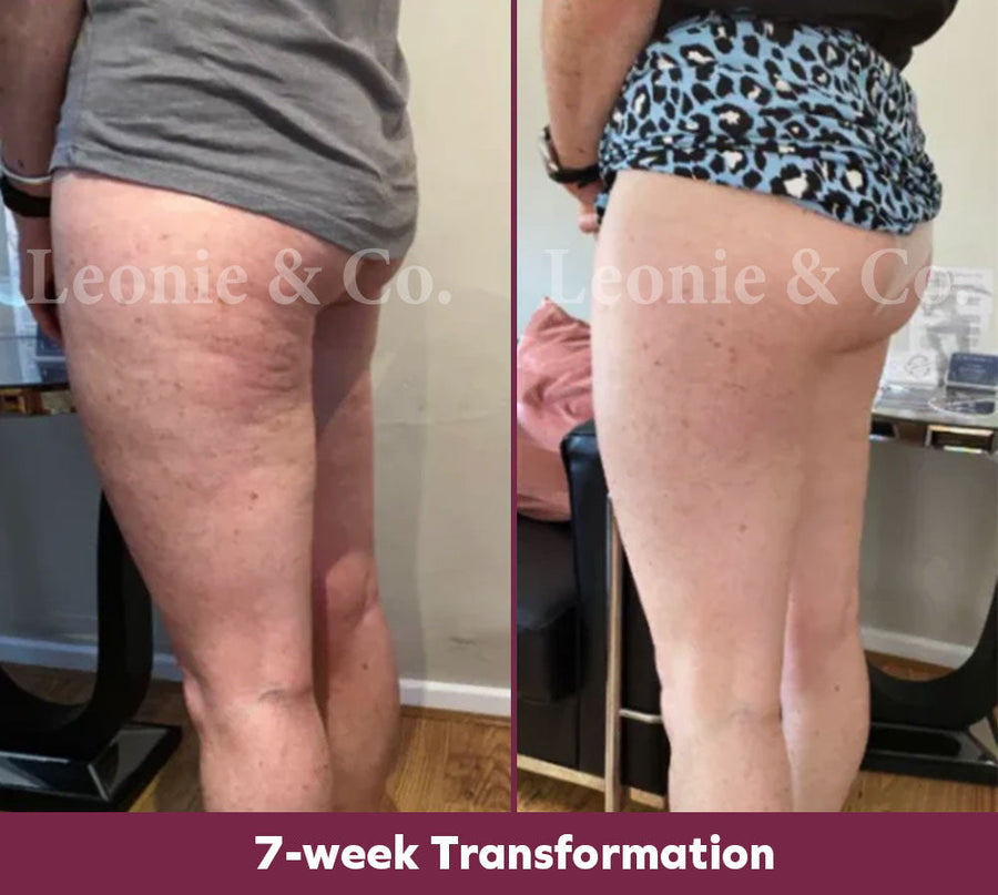 Claire (43 yrs)